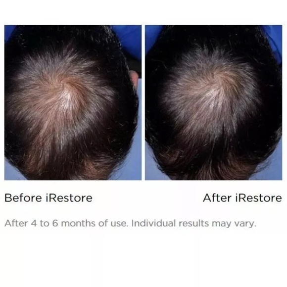 iRestore Essential 120 Laser Hair Growth System like new - Picture 13 of 14